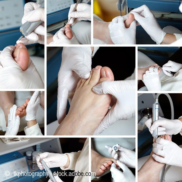 Medizinische Fußpflege Bewertungen in Deutschland | golocal